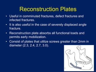 Reconstruction Plates
• Useful in comminuted fractures, defect fractures and
infected fractures.
• It is also useful in the case of severely displaced angle
fracture.
• Reconstruction plate absorbs all functional loads and
permits early mobilization.
• Consist of plates that utilize screws greater than 2mm in
diameter (2.3, 2.4, 2.7, 3.0).
 