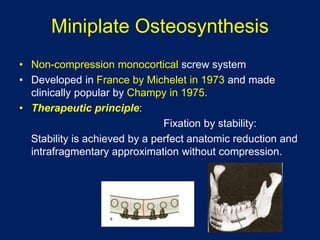 Miniplate Osteosynthesis
• Non-compression monocortical screw system
• Developed in France by Michelet in 1973 and made
clinically popular by Champy in 1975.
• Therapeutic principle:
Fixation by stability:
Stability is achieved by a perfect anatomic reduction and
intrafragmentary approximation without compression.
 