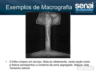 Exemplos de Macrografia
• O trilho rompeu em serviço. Nota-se nitidamente, nesta seção como
a fratura acompanhou o contorno da zona segregada. Ataque: iodo.
Tamanho natural.
 