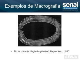 Exemplos de Macrografia
• Elo de corrente. Seção longitudinal. Ataque: iodo. 1,5 X.
 