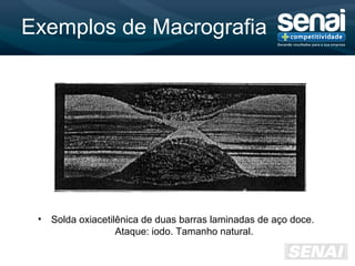 Exemplos de Macrografia
• Solda oxiacetilênica de duas barras laminadas de aço doce.
Ataque: iodo. Tamanho natural.
 