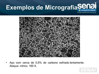 Exemplos de Micrografia
• Aço com cerca de 0,5% de carbono esfriado lentamente.
Ataque: nítrico. 160 X.
 