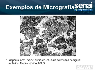 Exemplos de Micrografia
• Aspecto com maior aumento da área delimitada na figura
anterior. Ataque: nítrico. 800 X
 
