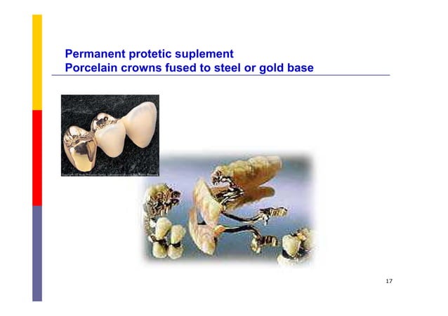 Metals In Dentistry PDF