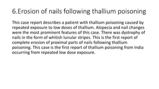 Metal toxicity presentation-Forensic 