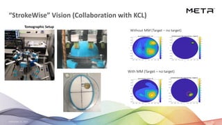 September 23, 2020 19
“StrokeWise” Vision (Collaboration with KCL)
Tomographic Setup
 