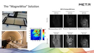September 23, 2020 24
The “MagneWise” Solution
META Prototype MRI Scans
RawdataBmpimages
Metasurface OFF Power Optimized Metasurface ON
 