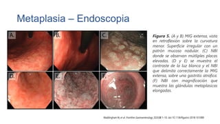 Metaplasia Intestinal Gastrica | PDF