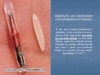 INSERÇÃO DO MICROCHIP
A NOVA MOEDA DO MUNDO
“E faz que a todos, pequenos e
grandes, ricos e pobres, livres e
servos, lhes seja posto um sinal
na sua mão direita, ou nas suas
testas, para que ninguém possa
comprar ou vender, senão aquele
que tiver o sinal, ou o nome da
besta, ou o número do seu nome.”
Apocalipse 13:16-17.
 