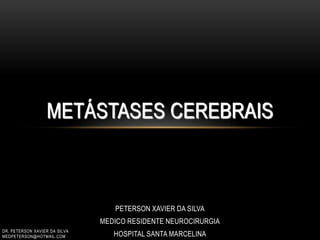 METÁSTASES CEREBRAIS
PETERSON XAVIER DA SILVA
MEDICO RESIDENTE NEUROCIRURGIA
HOSPITAL SANTA MARCELINA
DR. PETERSON XAVIER DA SILVA
MEDPETERSON@HOTMAIL.COM
 