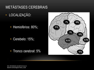 METÁSTASES CEREBRAIS
• LOCALIZAÇÃO:
• Hemisférios: 80%;
• Cerebelo: 15%;
• Tronco cerebral: 5%
DR. PETERSON XAVIER DA SILVA
MEDPETERSON@HOTMAIL.COM
 