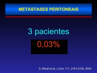 METÁSTASES PERITONEAIS 3 pacientes 0,03% S. Micali et al, J Urol, 171, 2151-2154, 2004 
