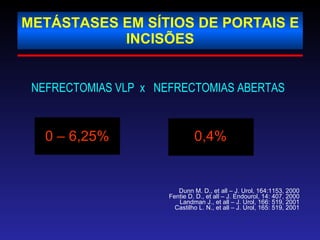 METÁSTASES EM SÍTIOS DE PORTAIS E INCISÕES NEFRECTOMIAS VLP  x  NEFRECTOMIAS ABERTAS   0 – 6,25% 0,4% Dunn M. D., et all – J. Urol, 164:1153, 2000 Fentie D. D., et all – J. Endourol, 14: 407, 2000 Landman J., et all – J. Urol, 166: 519, 2001 Castilho L. N., et all – J. Urol, 165: 519, 2001 