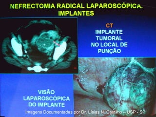 Imagens Documentadas por Dr. Lísias N. Castilho – USP - SP 