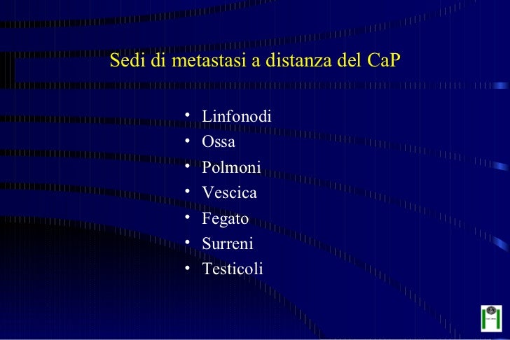 Metastasi Ossee E Carcinoma Prostatico