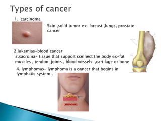 1. carcinoma
Skin ,solid tumor ex- breast ,lungs, prostate
cancer
2.lukemias-blood cancer
3.sacroma- tissue that support connect the body ex-fat
muscles , tendon, joints , blood vessels ,cartilage or bone
4. lymphomas- lymphoma is a cancer that begins in
lymphatic system .
 