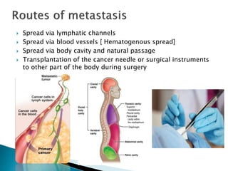  Spread via lymphatic channels
 Spread via blood vessels [ Hematogenous spread]
 Spread via body cavity and natural passage
 Transplantation of the cancer needle or surgical instruments
to other part of the body during surgery
 