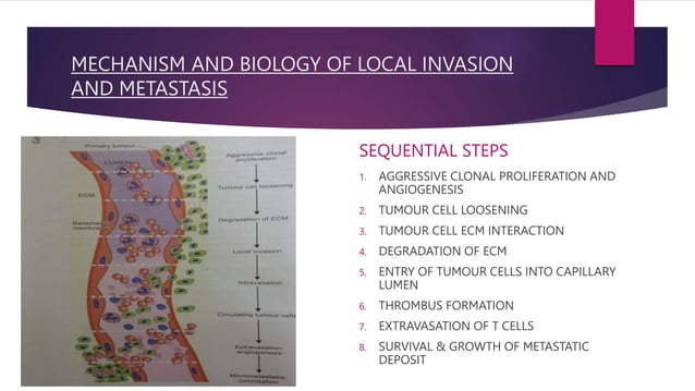 Metastasis And Metastatic Cancer Pathology Pptx Cancer Diseases