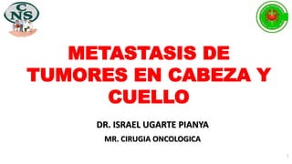 DR. ISRAEL UGARTE PIANYA
MR. CIRUGIA ONCOLOGICA
METASTASIS DE
TUMORES EN CABEZA Y
CUELLO
1
 