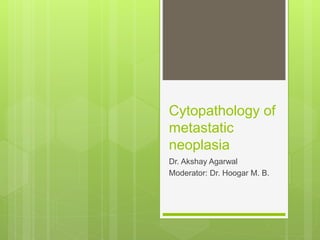 Cytopathology of
metastatic
neoplasia
Dr. Akshay Agarwal
Moderator: Dr. Hoogar M. B.
 