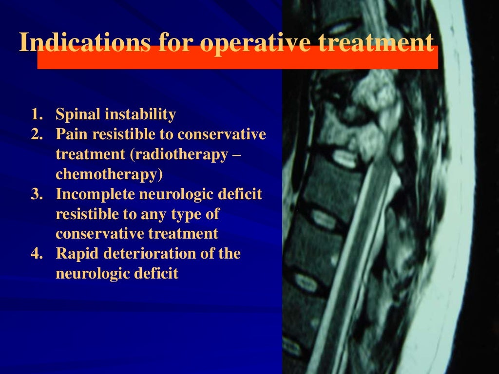 Metastatic Tumors of the Spinal Column