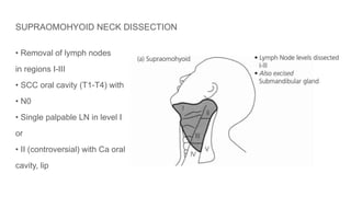 SUPRAOMOHYOID NECK DISSECTION
• Removal of lymph nodes
in regions I-III
• SCC oral cavity (T1-T4) with
• N0
• Single palpable LN in level I
or
• II (controversial) with Ca oral
cavity, lip
 