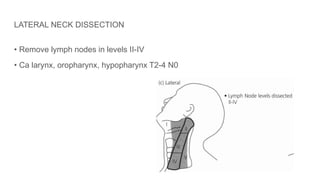 LATERAL NECK DISSECTION
• Remove lymph nodes in levels II-IV
• Ca larynx, oropharynx, hypopharynx T2-4 N0
 