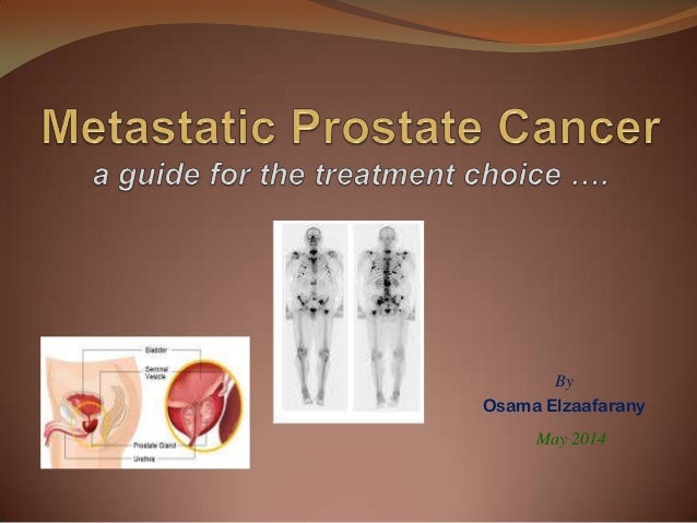 Metastatic Prostate Cancer A Guide For Treatment Choice