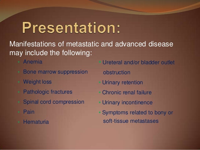 prostate cancer powerpoint presentation Investigation and management of prostate cancer ppt download.