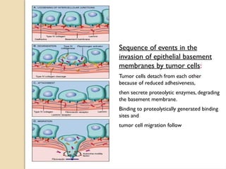 Comprehensive Overview of Metastatic Signature and Tumor Metastasis ...
