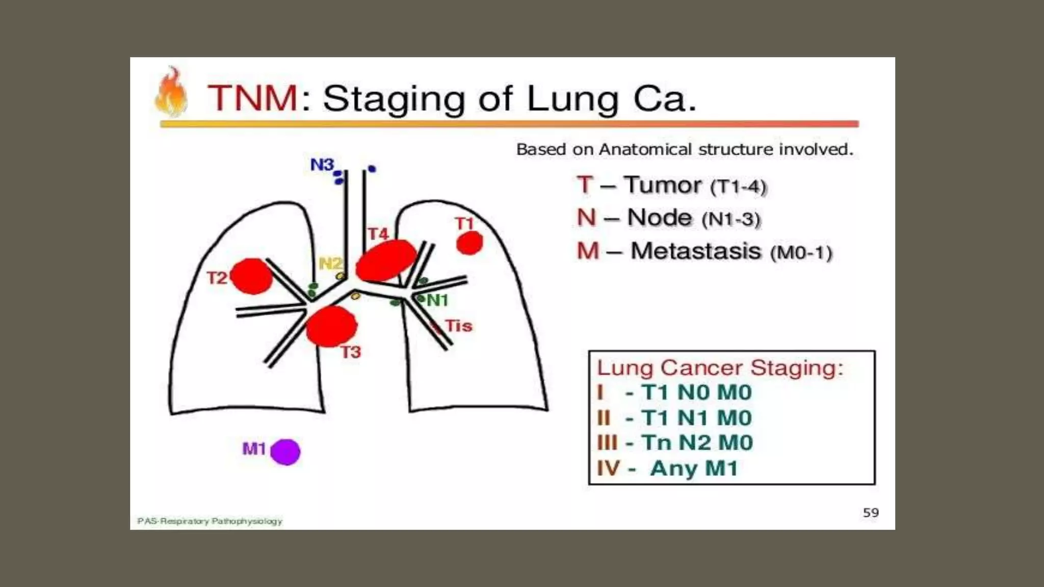 Metastatic tumors to lymph node