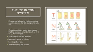 THE “N” IN TNM
SYSTEM
• If no cancer is found in the lymph nodes
near the cancer, the N is assigned a value
of 0.
• If nearby or distant nodes show cancer,
the N is assigned a number (such as 1, 2
or 3), depending on
 how many nodes are affected,
 how much cancer is in them,
 how large they are,
 and where they are located.
 