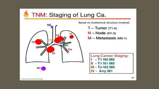 Metastatic tumors to lymph node