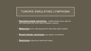 TUMORS SIMULATING LYMPHOMA
• Nasopharyngeal carcinoma - undifferentiated (tumor cells mix
with lymphocytes and tumor does not appear cohesive)
• Melanoma (tumor cells separate from each other within clusters)
• Breast lobular carcinoma (may appear noncohesive)
• Seminoma (inguinal and abdominal nodes)
 