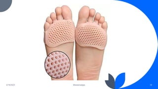 3/19/2023 Metatarsalgia 19
 