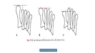 Humnt metatarsalgias HUMNT.pptx descripcion de patología | PPTX