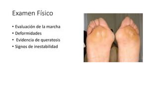 Humnt metatarsalgias HUMNT.pptx descripcion de patología | PPTX