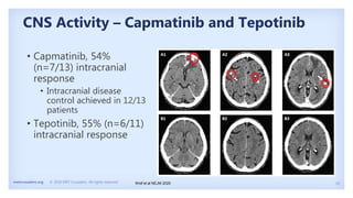 19
metcrusaders.org © 2020 MET Crusaders. All rights reserved.
CNS Activity – Capmatinib and Tepotinib
Wolf et al NEJM 2020
• Capmatinib, 54%
(n=7/13) intracranial
response
• Intracranial disease
control achieved in 12/13
patients
• Tepotinib, 55% (n=6/11)
intracranial response
 