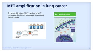 MET Crusader TKI presentation | PPT
