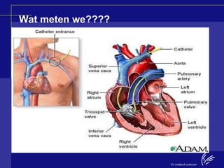 Sessie 3: Meten is weten asthma cardiale en cardiac outputmeting | PPT