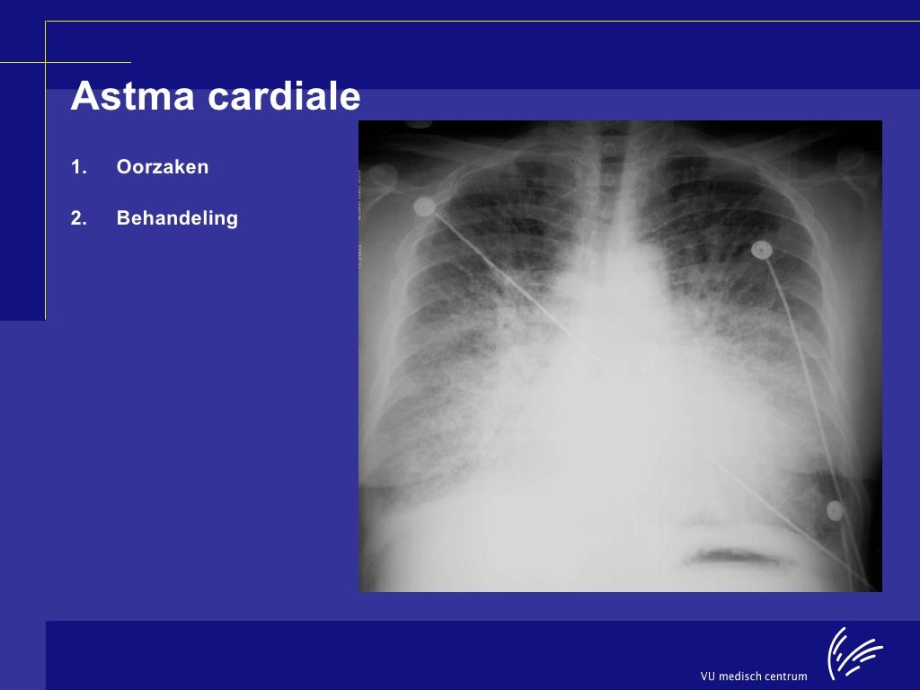 Sessie 3: Meten is weten asthma cardiale en cardiac outputmeting