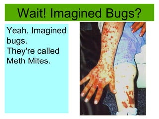 Wait! Imagined Bugs? Yeah. Imagined bugs.  They're called Meth Mites. 