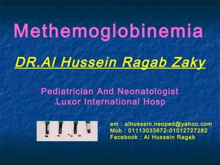 DR.Al Hussein Ragab Zaky
Pediatrician And Neonatologist
Luxor International Hosp.
Methemoglobinemia
em : alhussein.neoped@yahoo.com
Mob : 01113033672-01012727282
Facebook : Al Hussein Ragab
 