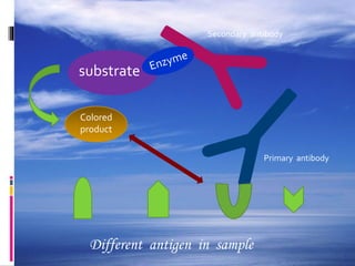 Different antigen in sample
substrate
Colored
product
Primary antibody
Secondary antibody
 