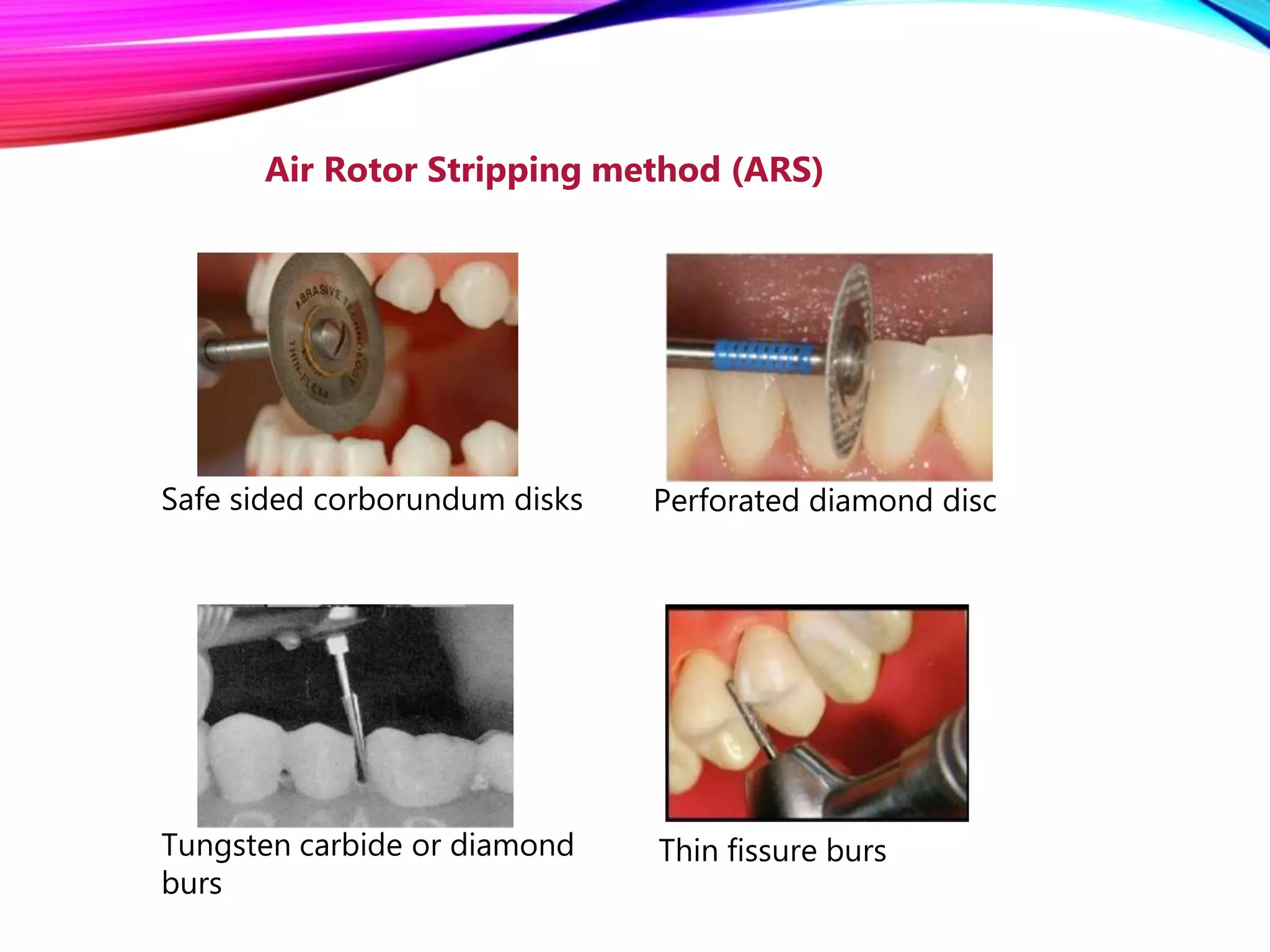 Method of gaining space | PPTX