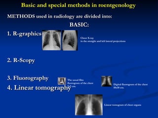 Methods for diagnosis for radiation presentation.ppt