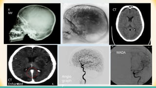 Methods OF BRAIN IMAGIN TECHNIQUE AND INVESTIGATION | PPTX