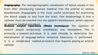 Wada Injection Methods OF BRAIN IMAGIN TECHNIQUE AND INVESTIGATION | PPTX