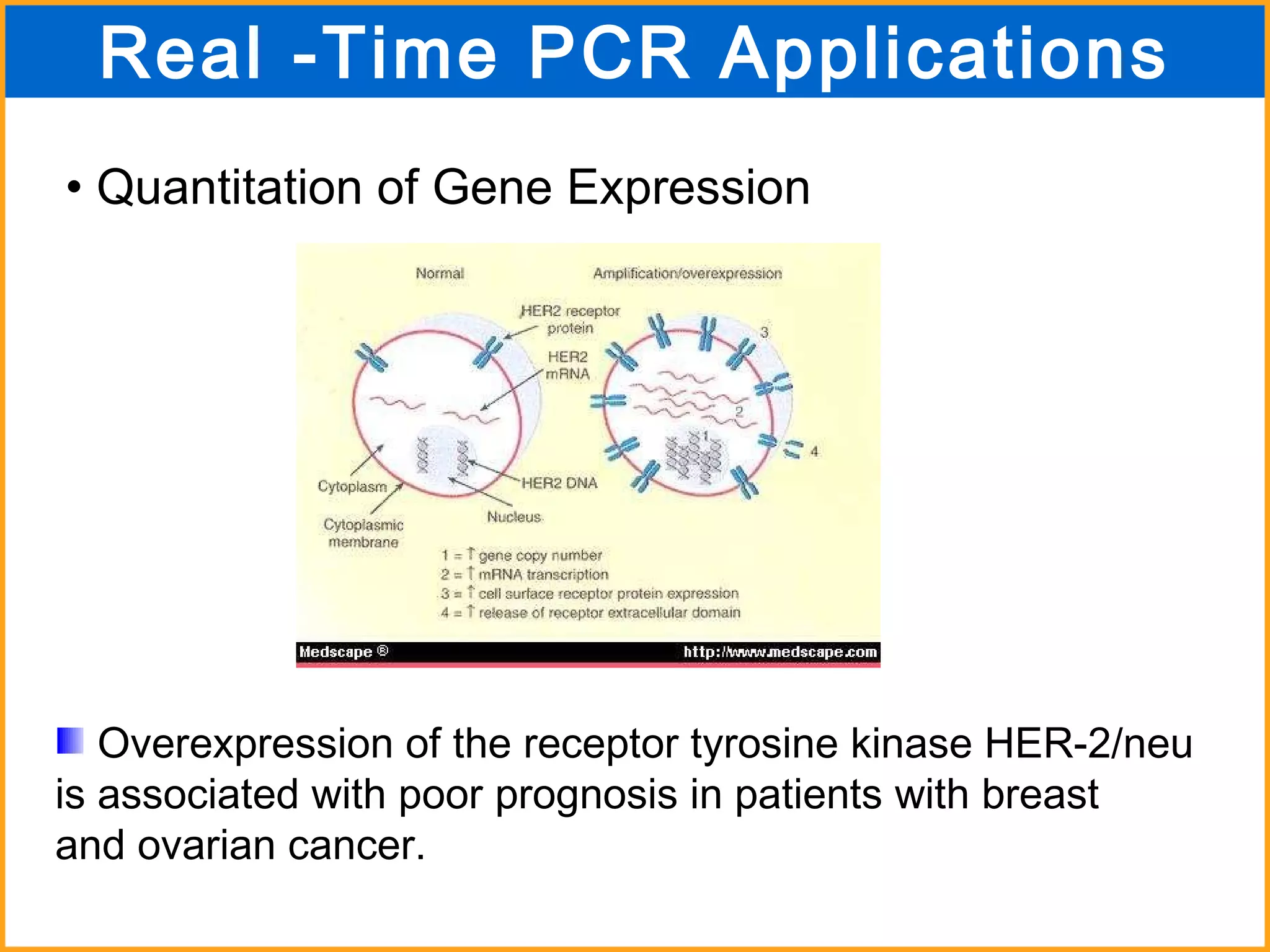 Quantitation of Gene Expression Overexpression of the receptor tyrosine kinase HER-2/neu  is associated with poor prognosis in patients with breast  and ovarian cancer. Real -Time PCR Applications 
