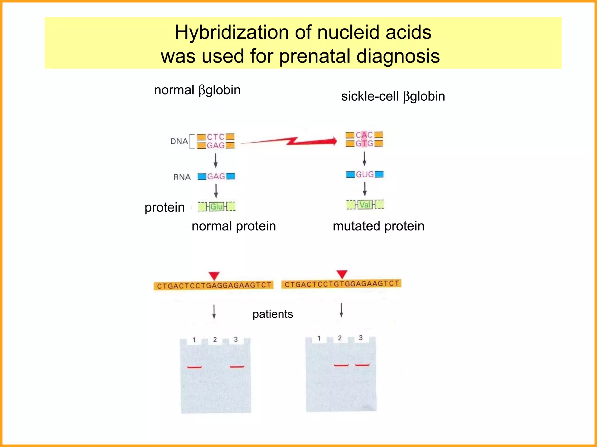 Hybridization of nucleid acids was used for prenatal diagnosis  normal   globin sickle-cell   globin normal protein mutated protein protein patients 